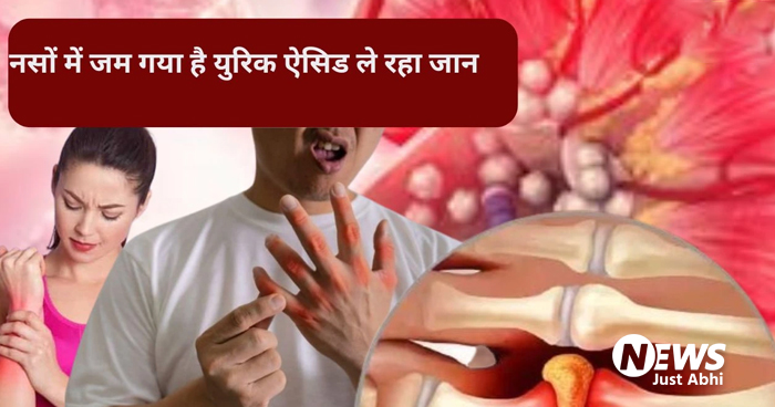 नसों में फैल गया है यूरिक एसिड? इस पीले फल का कर लिया जो सेवन. अंदर से नोच कर साफ करेगा सारी गंदगी!• ˠ