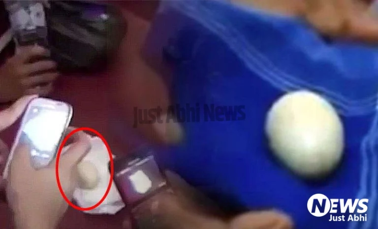 इंडोनेशिया में एक लड़का साल से अंडे दे रहा है, डॉक्टर्स भी हुए हैरान ˠ