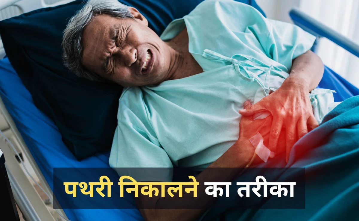 पथरी को मक्खन की तरह पिघला देगा ये जूस, राजीव दीक्षित के ये नुस्खे आ सकते हैं आपके काम