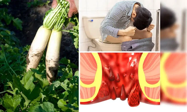 सालों पुरानी से पुरानी बवासीर एक हफ्ते में गायब? जानिए ये रहस्यमयी राज़, जो अब दुनिया से छुपा था....