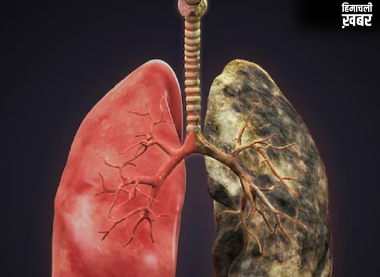 फल-सब्जियों से कैसे फैल रहा है लंग्स कैंसर, रिसर्च में हुआ चौंकाने वाला खुलासा