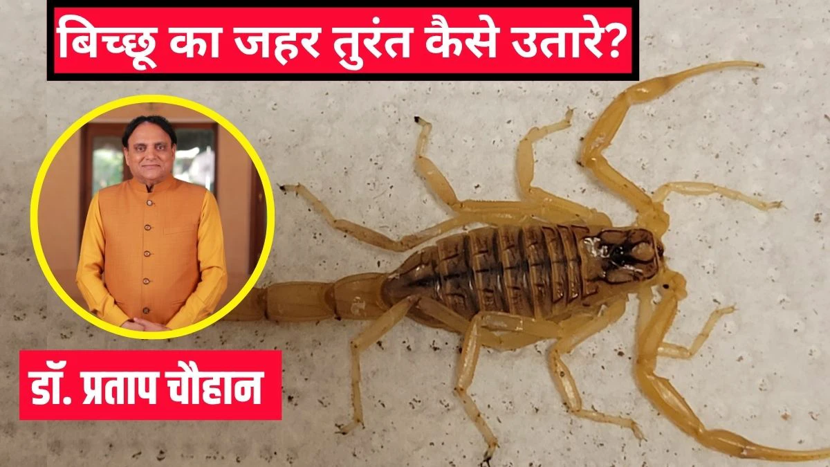 बिच्छू का जहर तुरंत कैसे उतारे? आयुर्वेदिक डॉक्टर ने बताया बिच्छू के काटने पर क्या करना चाहिए