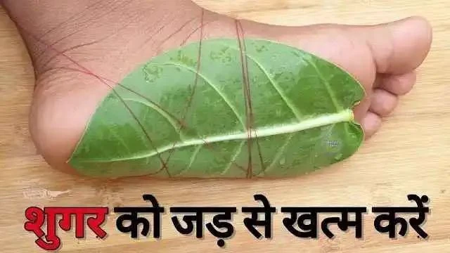 इस बिमारी का इलाज मिल गया, इस पत्‍ते को रात में अपने पैर पर लगा लें जड़ से खत्‍म हो जाएगी शुगर जैसी गंभीर बीमारी ....