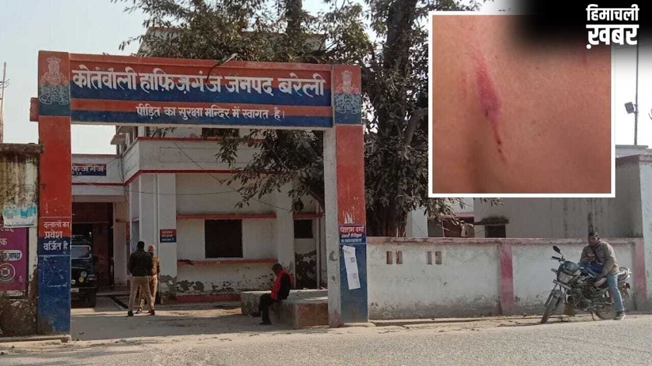 शहतूत तोड़ने की ऐसी सजा… तीन बच्चों को दी खौफनाक सजा, शख्स ने बेल्ट और केबल से पीटा