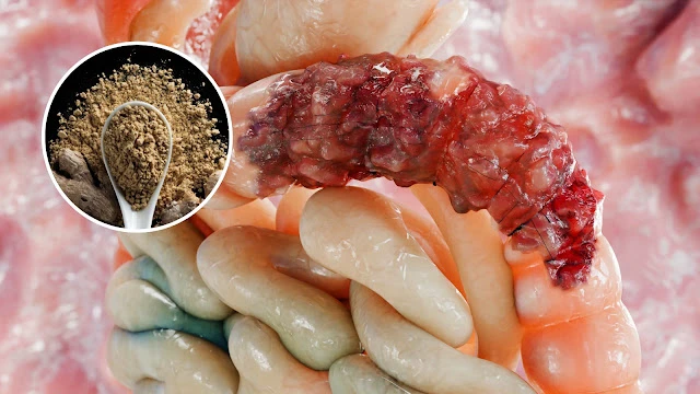 मल निकालने के बाद भी भरा रहता है पेट? मतलब आंतों में फंस गई है गंदगी, डॉक्टर सेठी ने बताया चूरन वाला नुस्खा