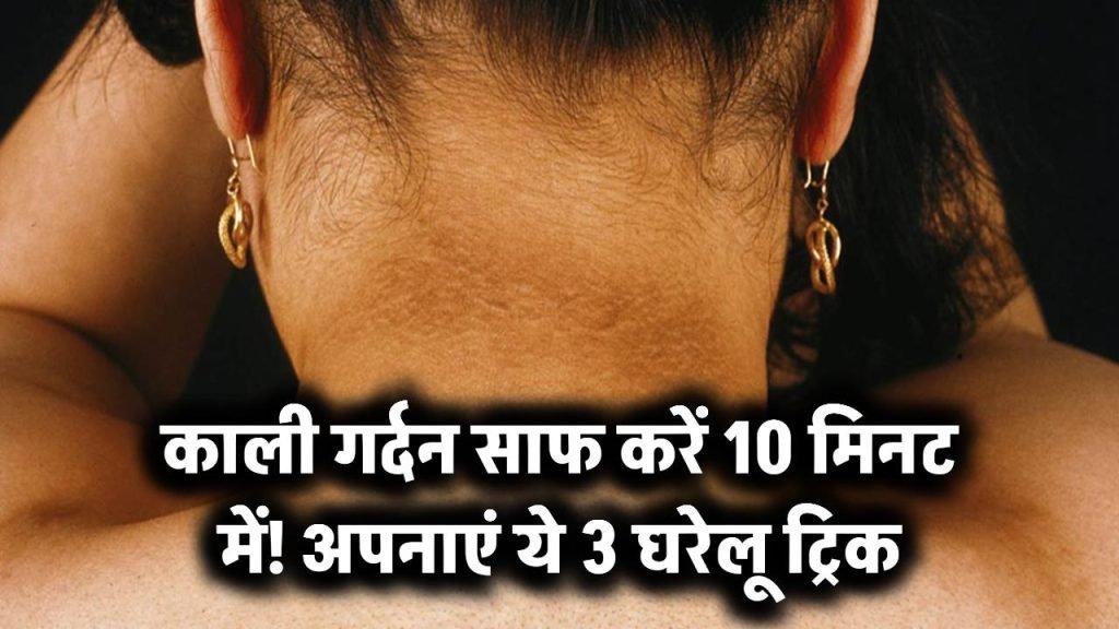 काली गर्दन की छुट्टी सिर्फ 10 मिनट में! अपनाएं ये 3 घरेलू ट्रिक – पहली बार में दिखेगा फर्क