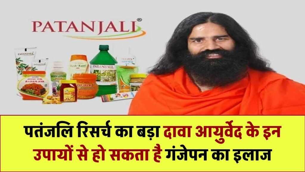 पतंजलि रिसर्च का बड़ा दावा – आयुर्वेद के इन उपायों से हो सकता है गंजेपन का इलाज Ayurvedic Hair Loss Treatment