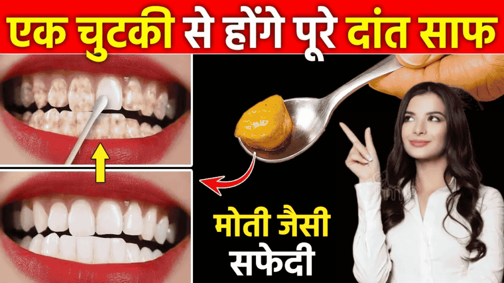 दांतों को सफेद और साफ करने का आसान उपाय, फिटकरी से घर पर बनाएं मंजन