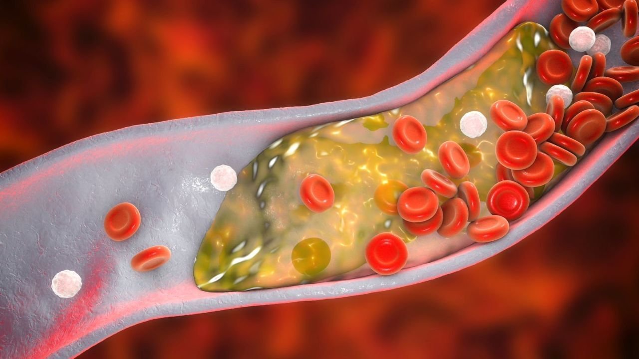 हार्ट में ब्लॉकेज होने पर जरूर दिखते हैं ये लक्षण, न करें नजरअंदाज