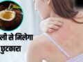 Summer Skin Care Remedy: गर्मी से हो रही खुजली-महीन दानों का होगा सफाया, नारियल तेल में मिलाकर लगा लें ये 1 चीज