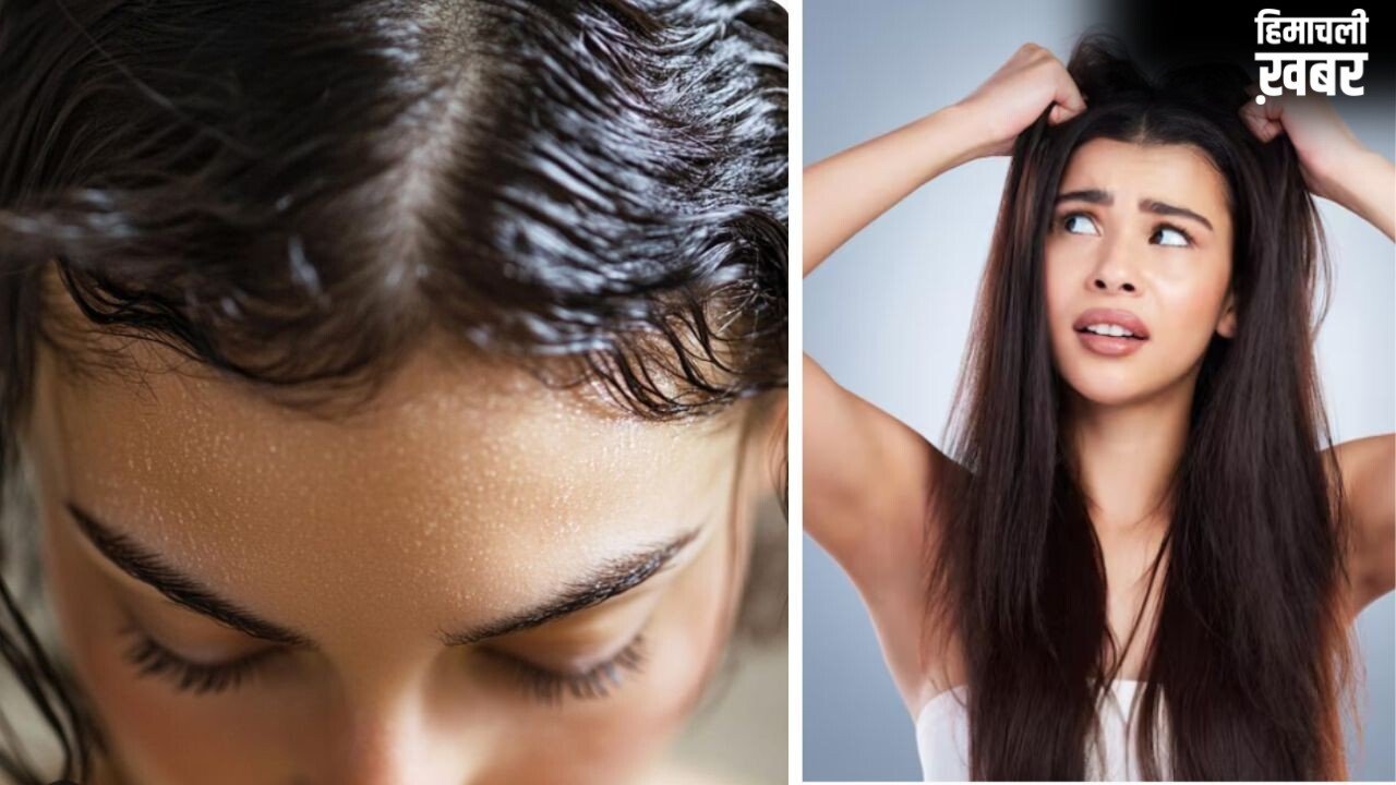 बालों को चिपचिपा होने से बचाने के लिए अपनाएं ये 3 नुस्खे, ऑयली स्कैल्प से मिल सकती है राहत