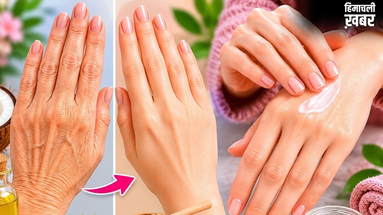 हाथों की झुर्रियां कम करने और नमी बनाए रखने के लिए अपनाएं ये आदतें​