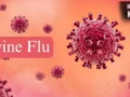 Swine Flu Prevention: बारिश के मौसम में क्यों बढ़ जाता है स्वाइन फ्लू का खतरा? जानें कैसे करें बचाव​