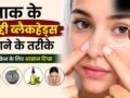 ब्लैकहेड्स हटेंगे और स्किन दिखेगी साफ, पोर्स में जमी गंदगी हटाने के लिए ट्राई करें ये आसान टिप्स