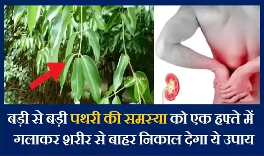 बड़ी से बड़ी पथरी की समस्या को एक हफ्ते में गलाकर शरीर से बाहर निकाल देगा ये उपाय