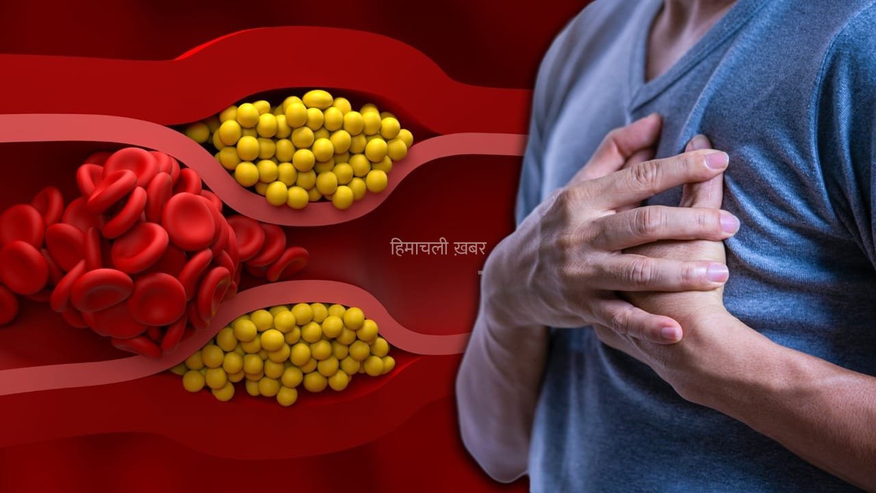 High Cholesterol: हाई कोलेस्ट्रॉल क्यों हो जाता है? ये गलतियां इसकी वजह बनती हैं
