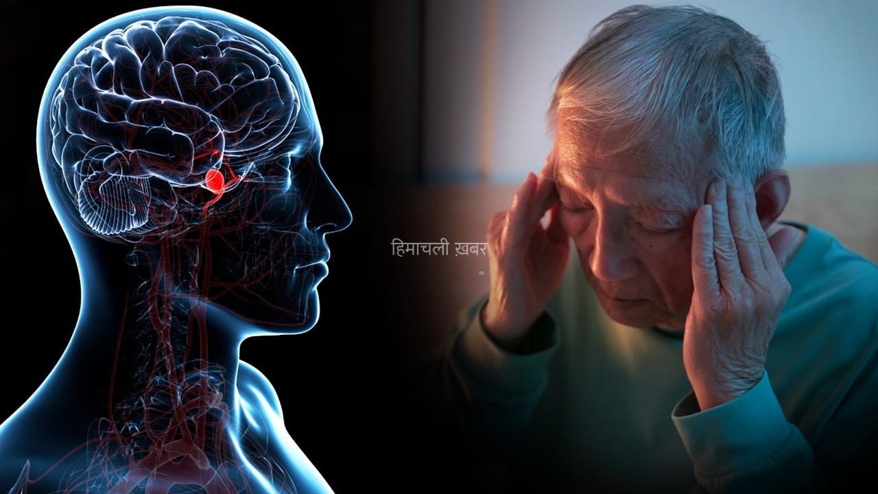 ब्रेन एन्यूरिज्म…दिमाग की नसों का गुबारे की तरह फूल जाना, ये क्यों होता है