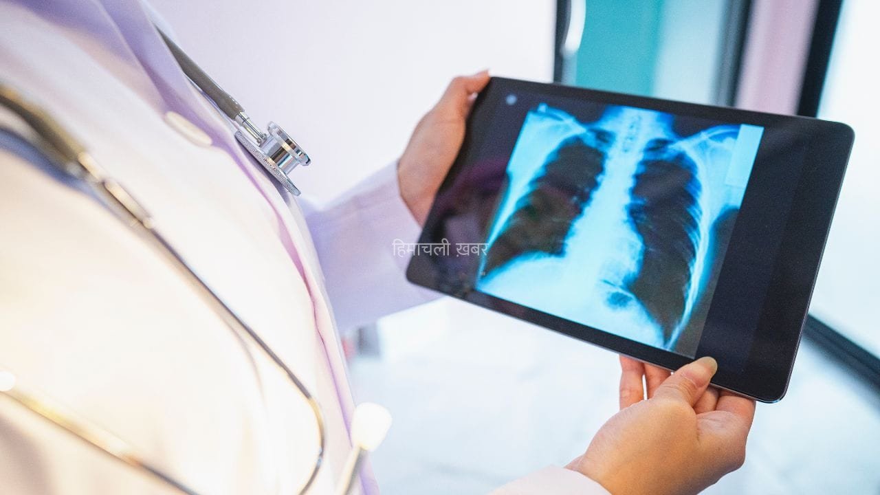 World Lung Cancer Day: किन लोगों को लंग कैंसर स्क्रीनिंग करवानी चाहिए और क्यों? एक्सपर्ट्स ने बताया​