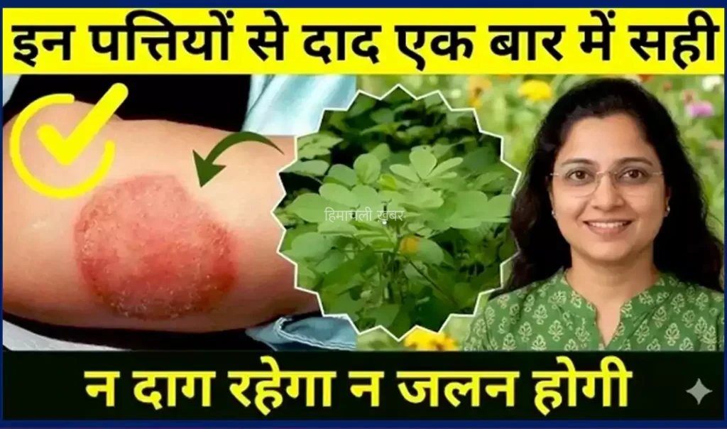 दाद को जड़ से मिटाने वाला शक्तिशाली आयुर्वेदिक नुस्खा, विस्तार में जानें इसके बारे में​​​