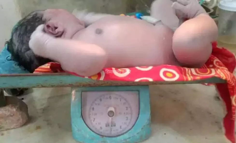 महिला ने दिया 5.2 KG के बच्चे को जन्म, देखकर डॉक्टर्स भी बोले- पहले नहीं देखा ऐसा बच्चा