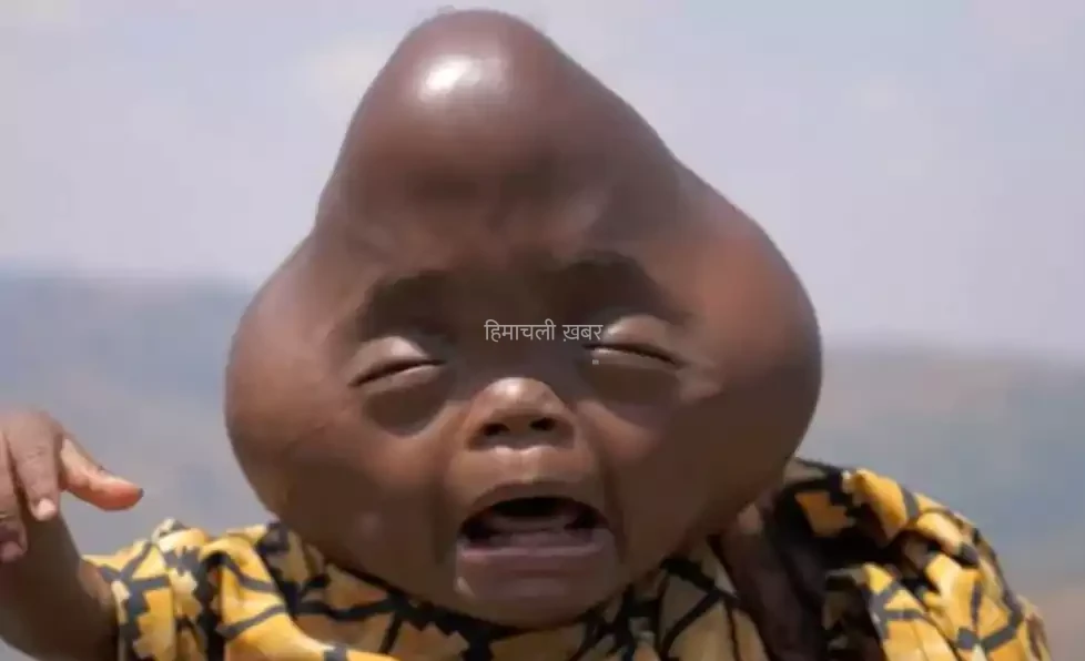 पत्नी ने दिया बेटे को जन्म, चेहरे देख डर गया पति, बोला- ये मेरा नहीं एलियन का बच्चा है.. पत्नी को छोड़ भाग गया पति