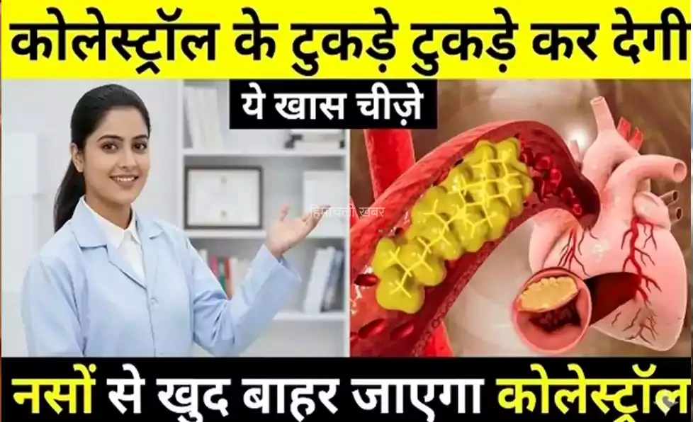 कोलेस्ट्रॉल के टुकड़े टुकड़े कर देगी ये खास चीज़े, नसों से खुद बाहर आ जायेगा कोलेस्ट्रॉल