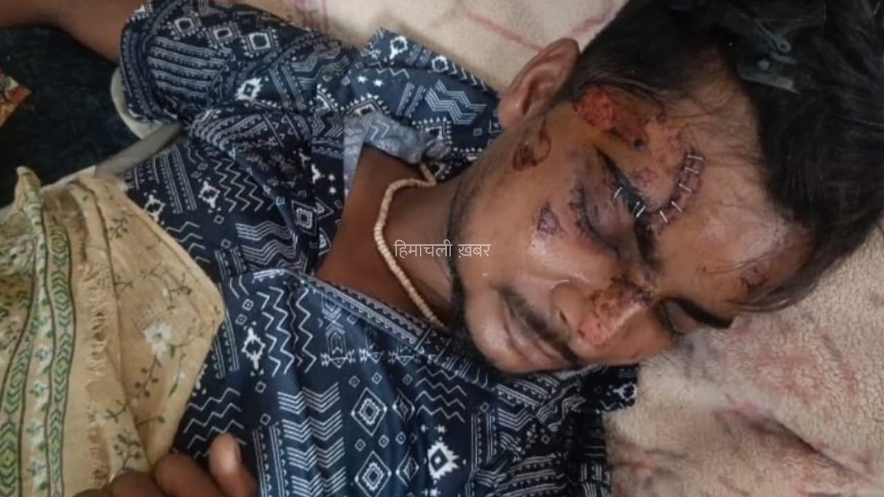 फ्लिपकार्ट कर्मी के जेब में फटा फोन, झुलसने पर टांकों की जगह डॉक्टर ने लगा दिए स्टेपलर पिन​
