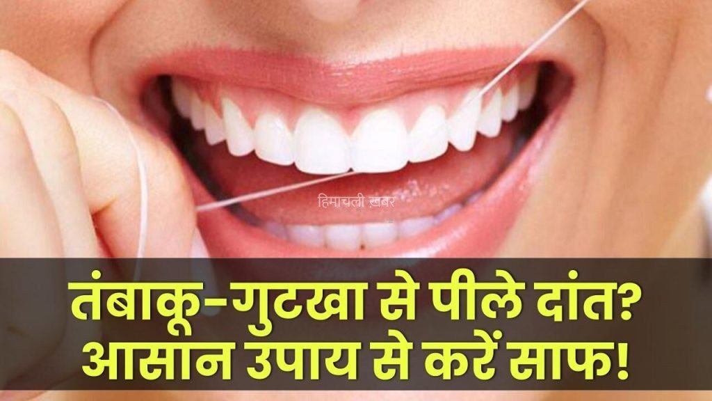 तंबाकू और गुटखा से पीले पड़े दांत? इन आसान उपायों से करें तुरंत साफ!