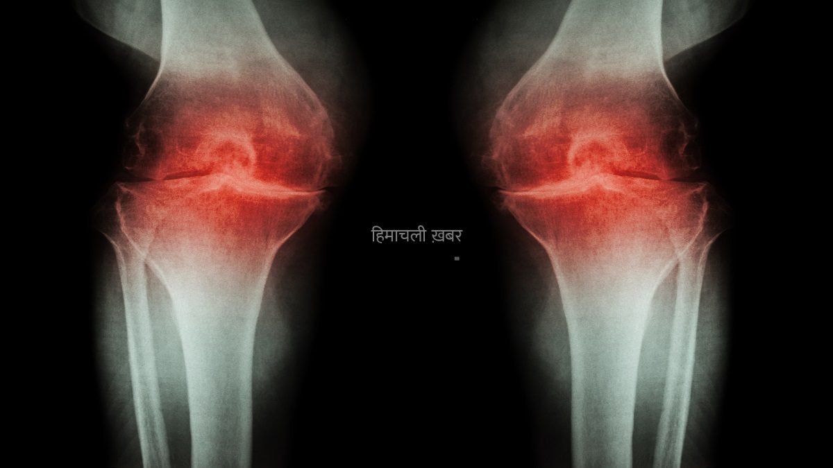 रोज झड़ेगा सारी 206 हड्डियों का कैल्शियम”, अगर ठीक नहीं हुई अंदर की 1 चीज, डॉक्टर की बात सुन छूटेंगे पसीने