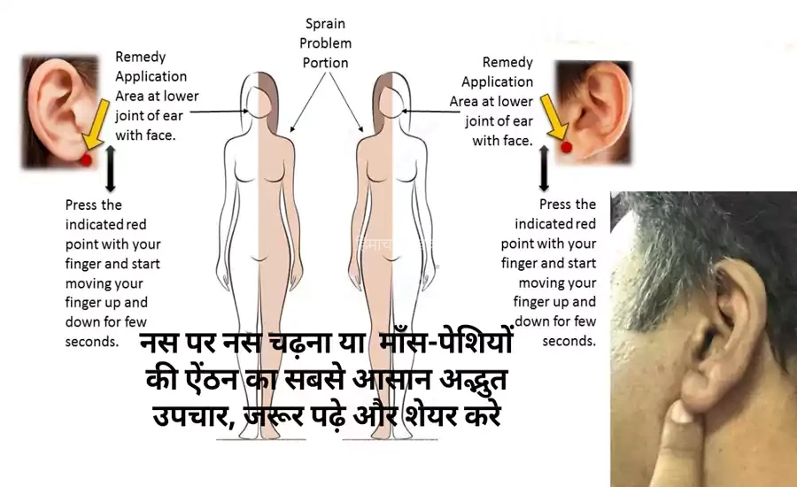 नस पर नस चढ़ना या माँस-पेशियों की ऐंठन का सबसे आसान अद्भुत उपचार, जरूर पढ़े और शेयर करे​​​