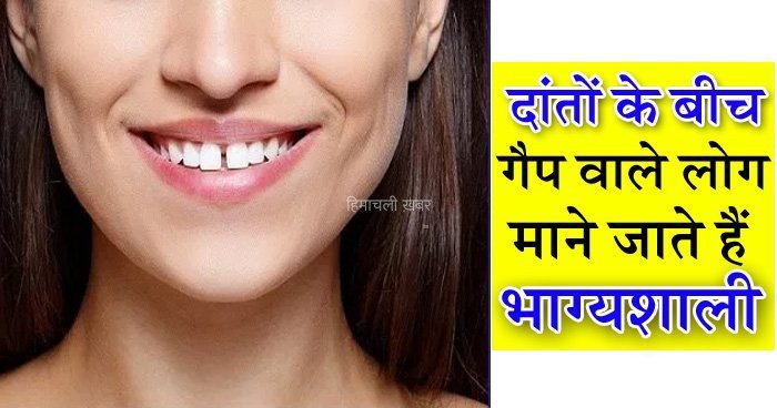 भाग्यशाली माने जाते हैं दांतों के बीच गैप वाले लोग ये 8 खूबियां उन्हें बनाती हैं सब से ख़ास