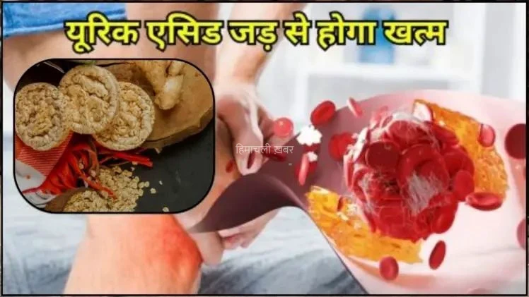 खून और जोड़ों में जमा सारा यूरिक एसिड बाहर निकल देगी 5 रुपये की ये चीज गठिया से भी मिल जाएगा छुटकारा​​​