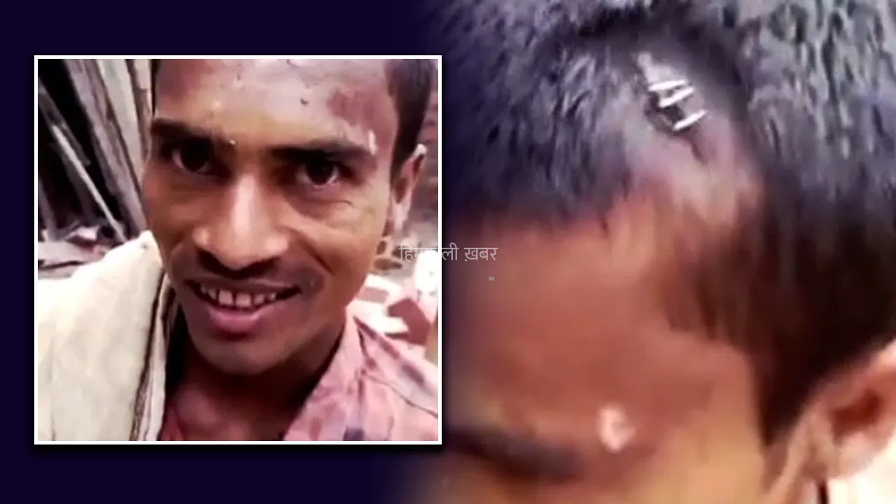 ​​सिर फटा था… डॉक्टर ने स्टेपलर चला दिया! डॉक्टर या मजाक?…,नवादा में झोलाछाप डॉक्टर का अजीब इलाज वायरल​​​