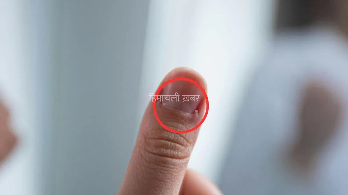 प्रतीकात्मक फोटो- India TV Hindi
