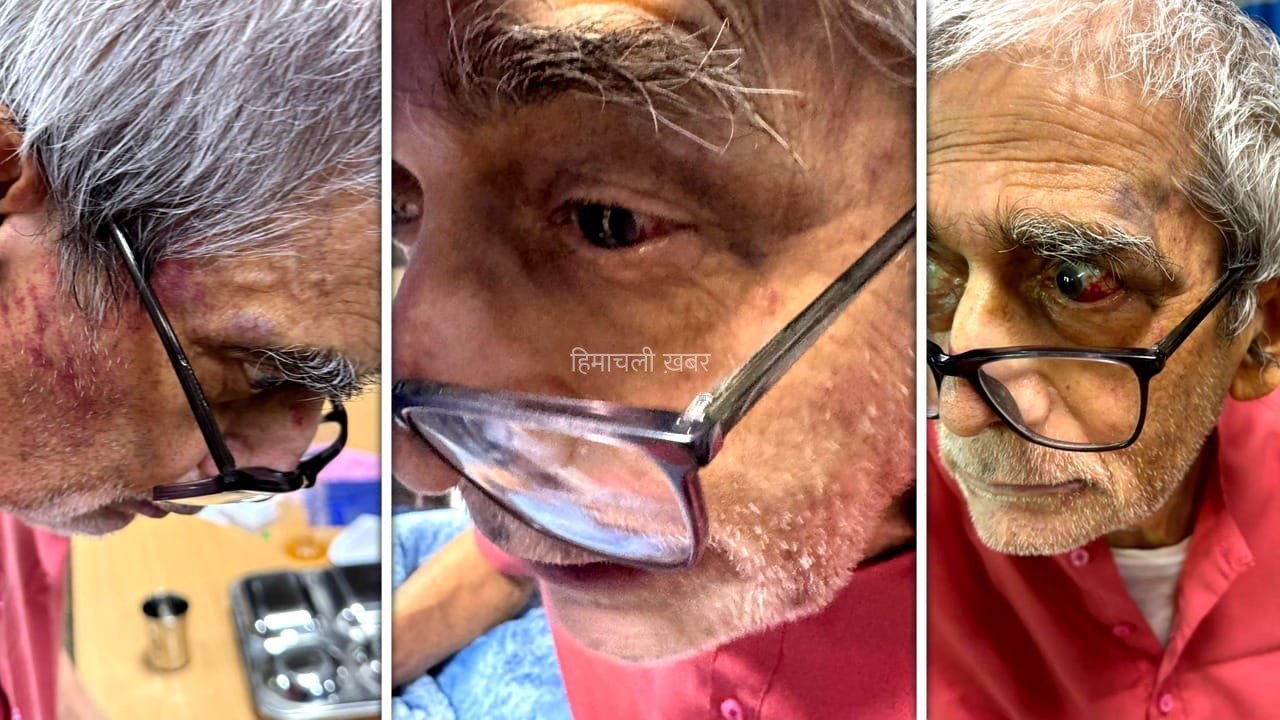 BHU में पद्मश्री डॉ. टीके लाहिड़ी से मारपीट… एक हफ्ते बाद भी कार्रवाई नहीं, परिजनों ने की ये मांग​