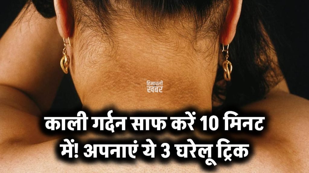 काली गर्दन की छुट्टी सिर्फ 10 मिनट में! अपनाएं ये 3 घरेलू ट्रिक – पहली बार में दिखेगा फर्क